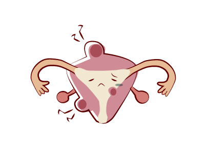 更年期に注意すべき病気：子宮筋腫